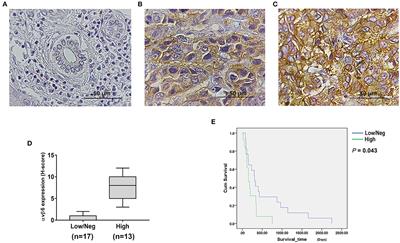 Chimeric Antigen Receptor T Cells Targeting Integrin αvβ6 Expressed on Cholangiocarcinoma Cells